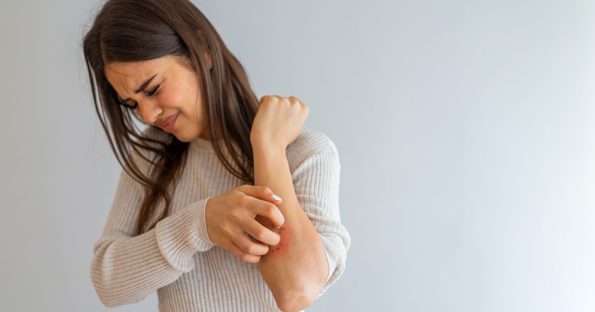 eczema treatment chicago