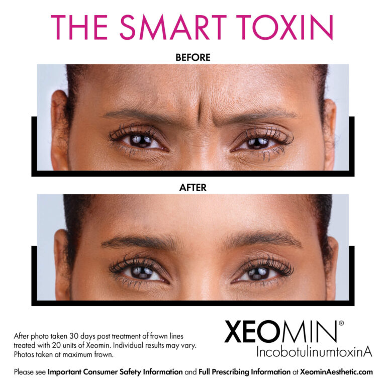 Botox & Neuromodulators at Chicago Skin Clinic