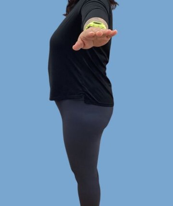 Chicago Skin Clinic patient before completing the medical weight loss program