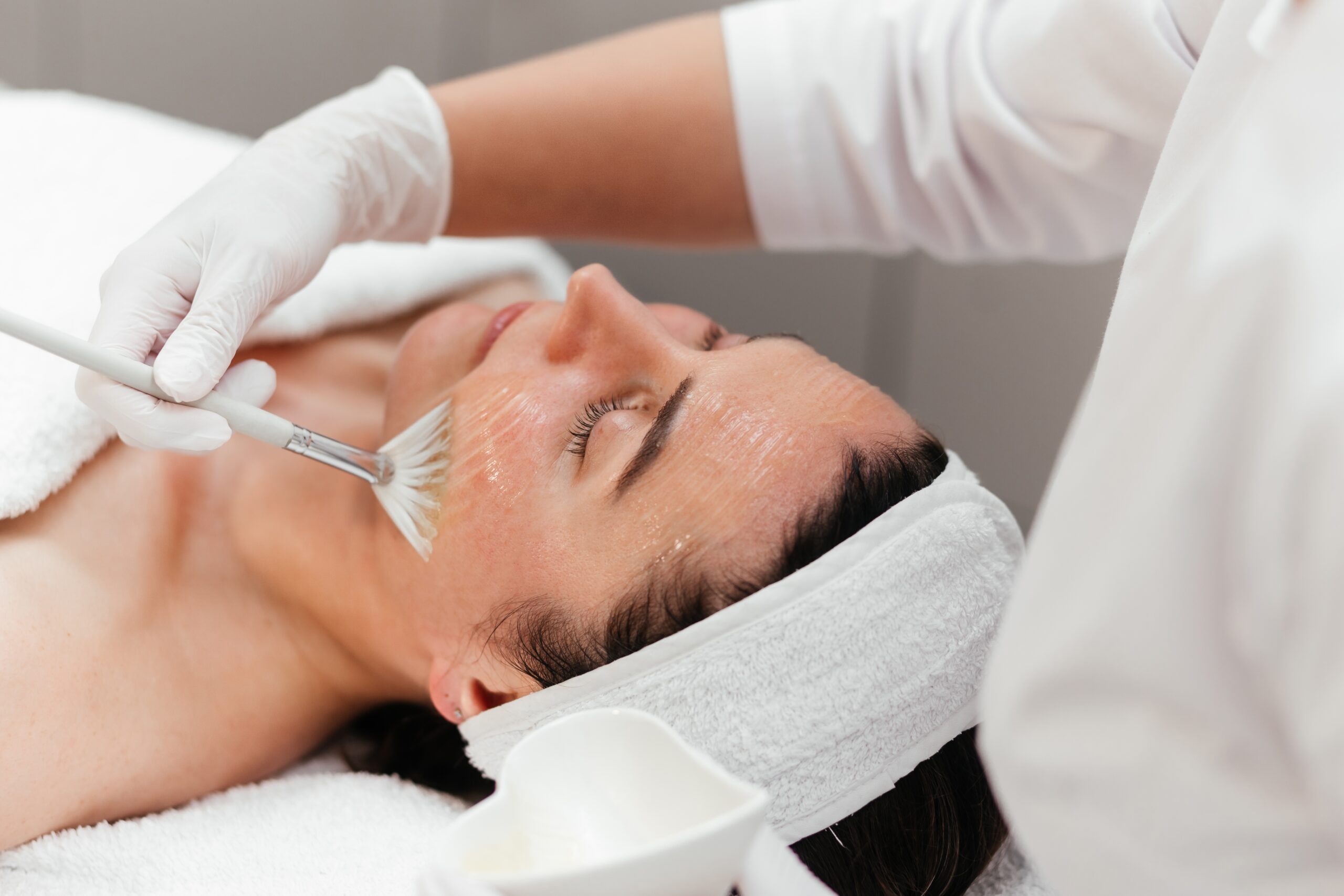 Microdermabrasion vs. Chemical Peels: Which Is Better for Chicago Skin?